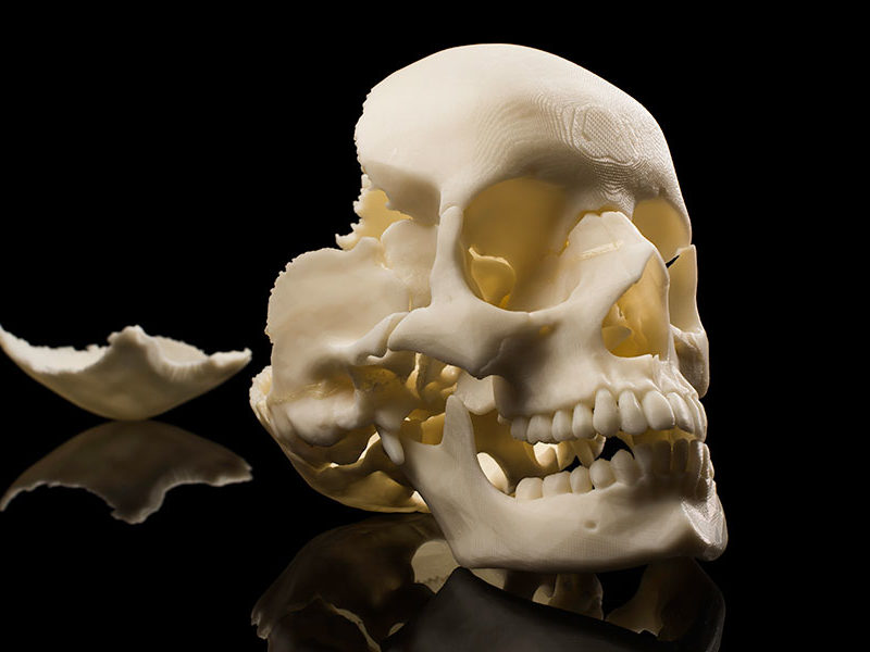 3D printed skull from the lab of Ahmed Ghazi