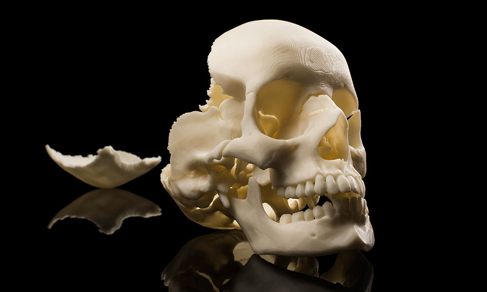 3D printed skull from the lab of Ahmed Ghazi
