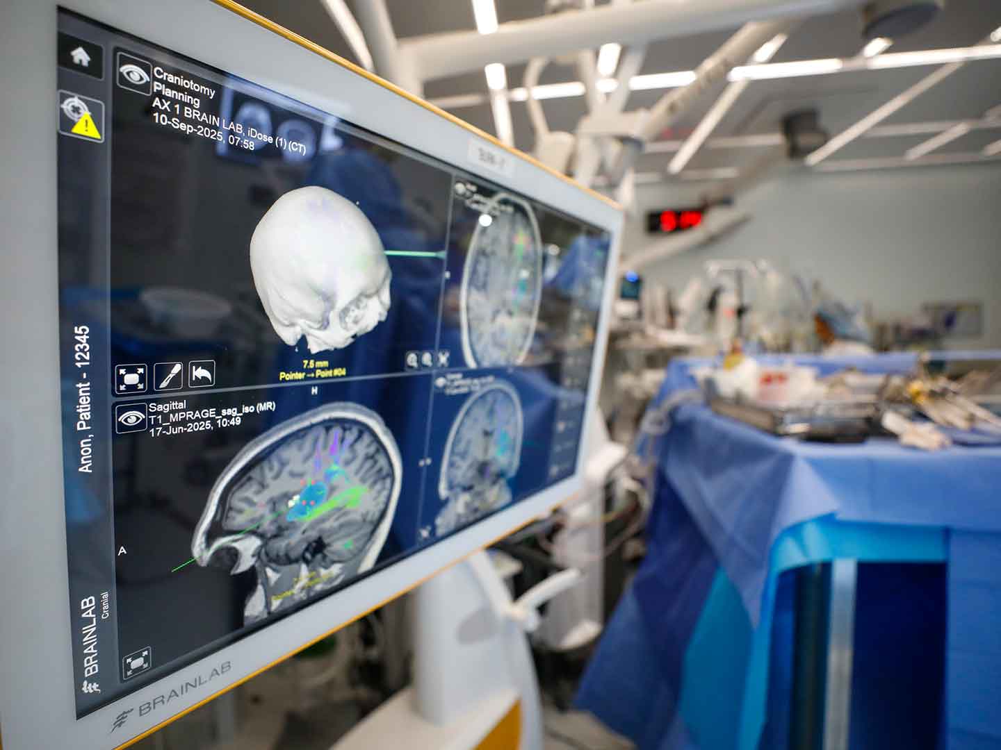 A monitor that shows brainscans in a surgery room