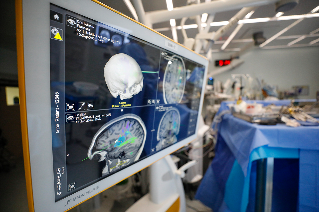 A monitor that shows brainscans in a surgery room